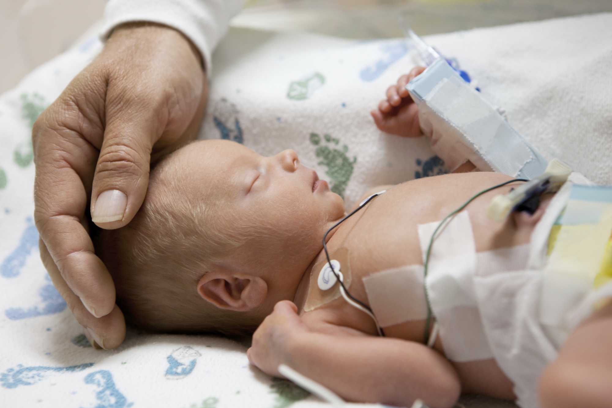 Birth Injury Malpractice Lawsuits | Little Rock, Arkansas