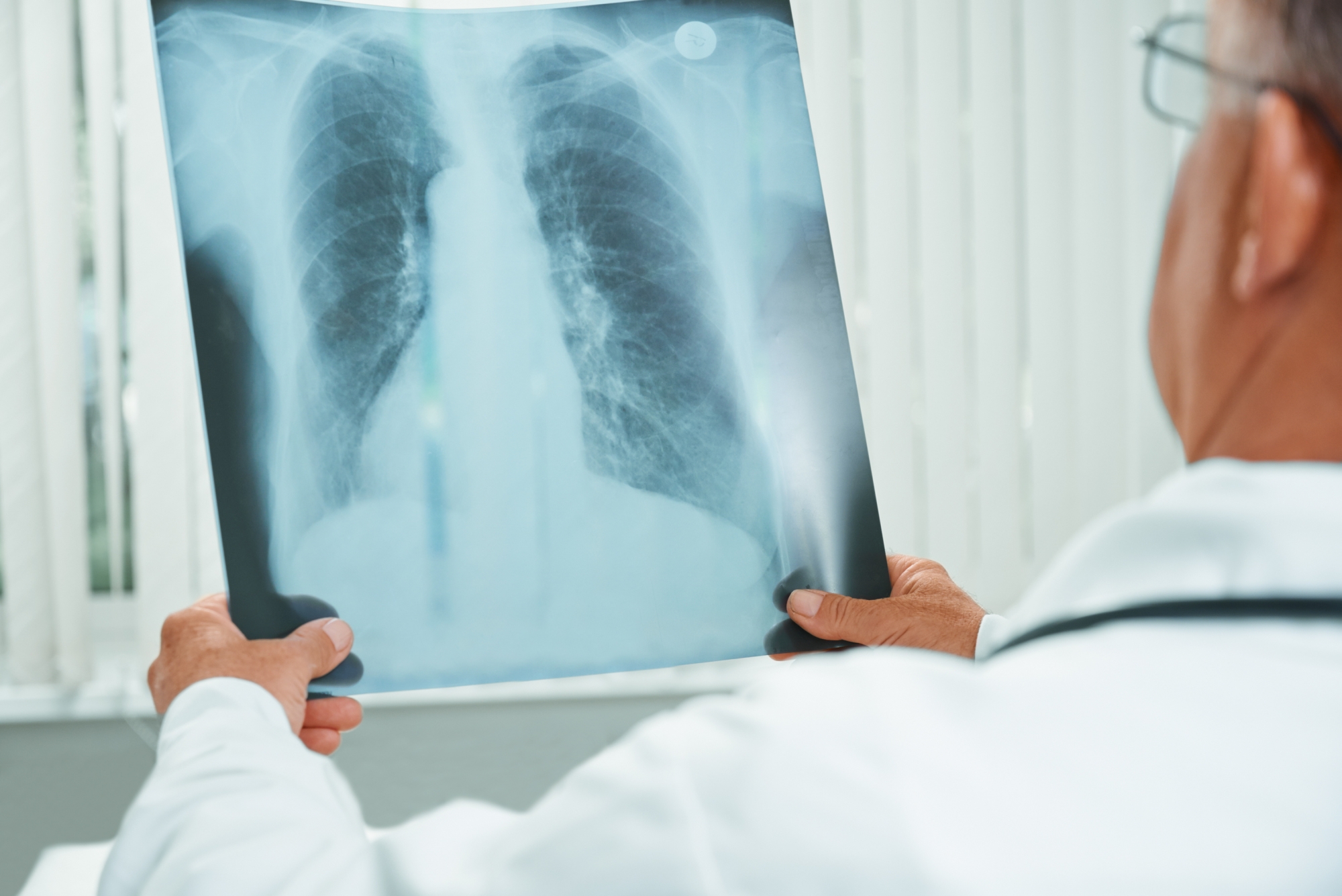Misdiagnosis of Cancer Lawsuit | Polewski & Associates